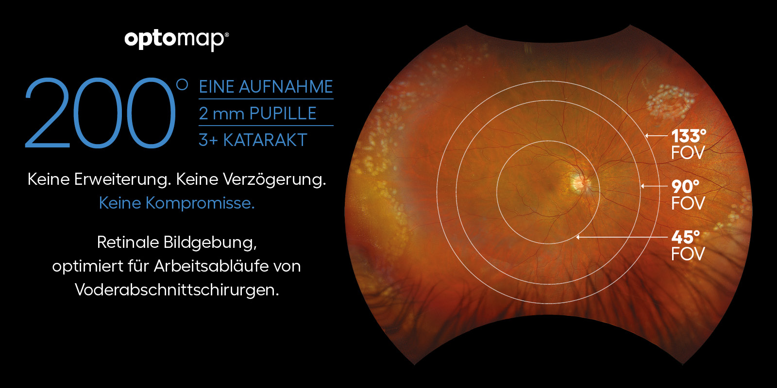 200 degree optomap