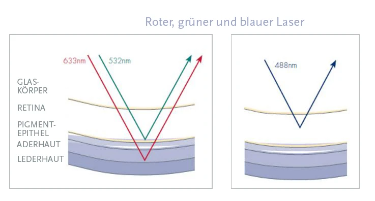 Koh&auml;rente Laserstrahlen